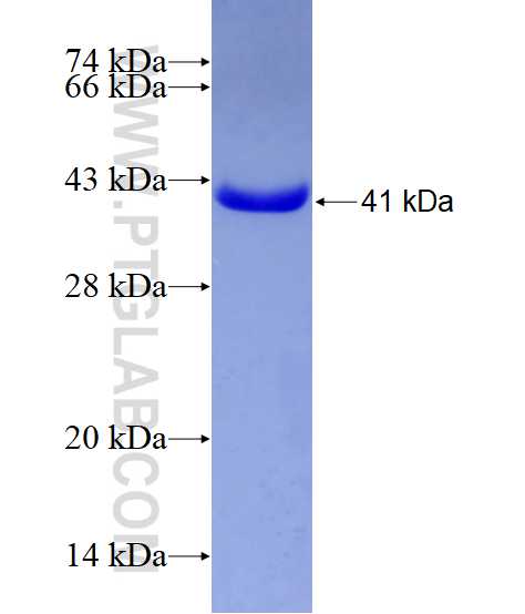 KBTBD2 fusion protein Ag4933 SDS-PAGE