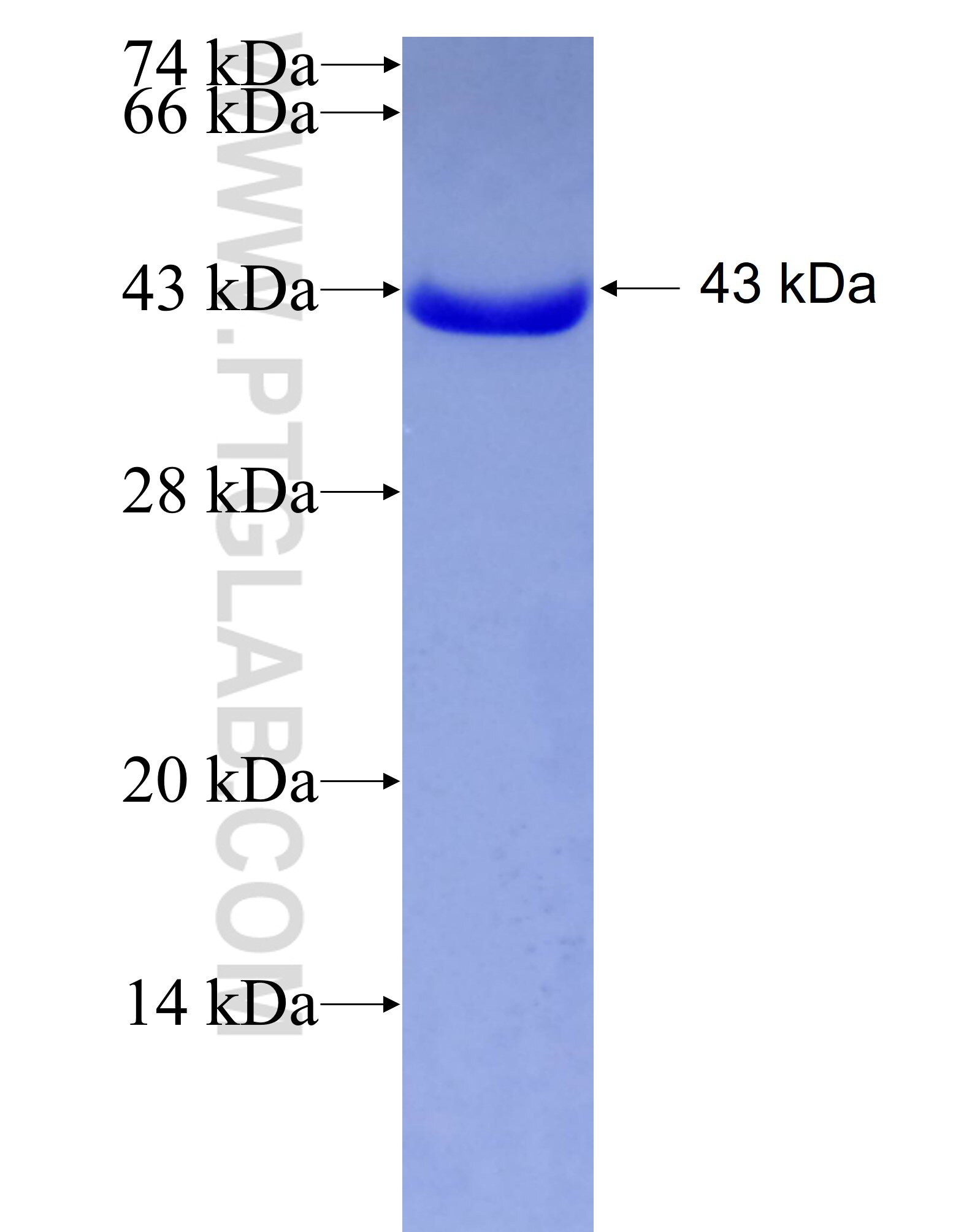 KBTBD2 fusion protein Ag4933 SDS-PAGE