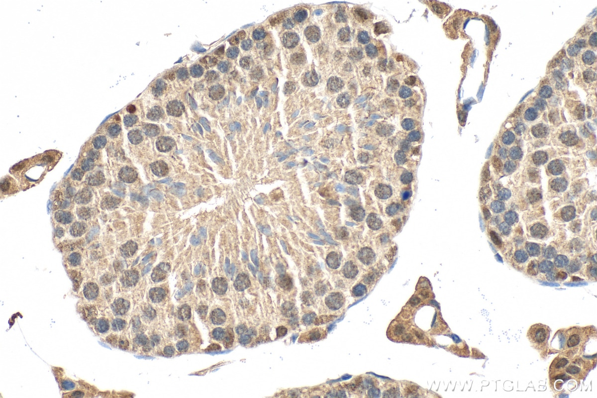 Immunohistochemistry (IHC) staining of mouse testis tissue using KBTBD4 Polyclonal antibody (20428-1-AP)