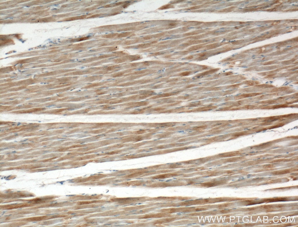 IHC staining of human skeletal muscle using 21836-1-AP