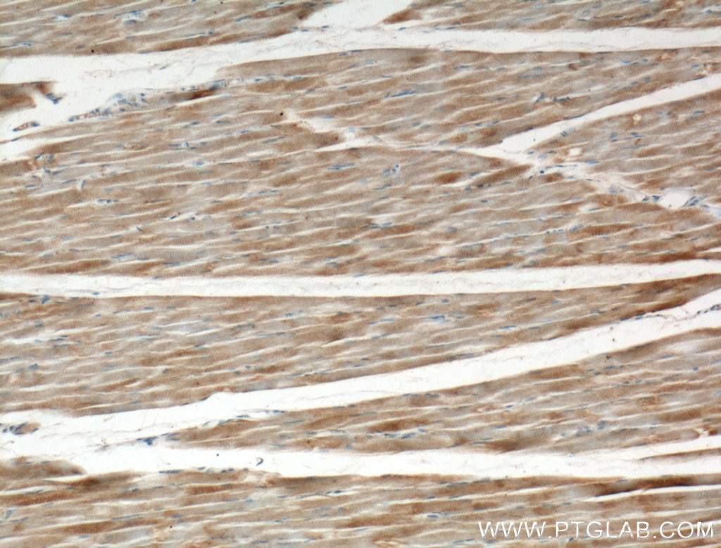 Immunohistochemistry (IHC) staining of human skeletal muscle tissue using KBTBD5 Polyclonal antibody (21836-1-AP)