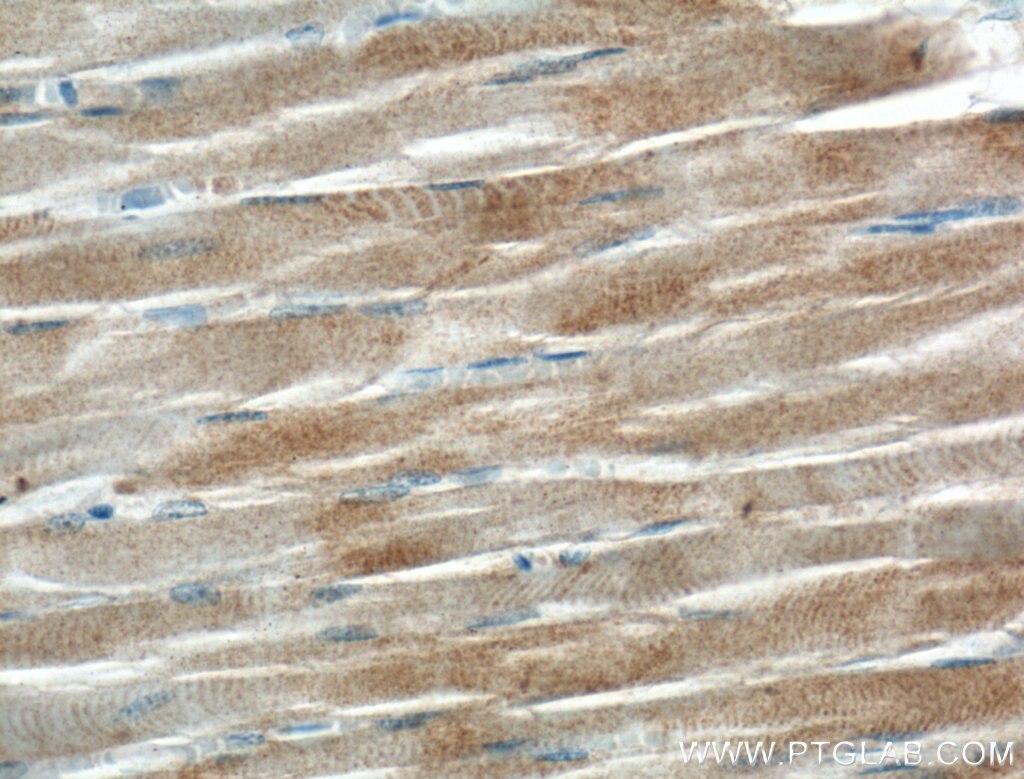 Immunohistochemistry (IHC) staining of human skeletal muscle tissue using KBTBD5 Polyclonal antibody (21836-1-AP)