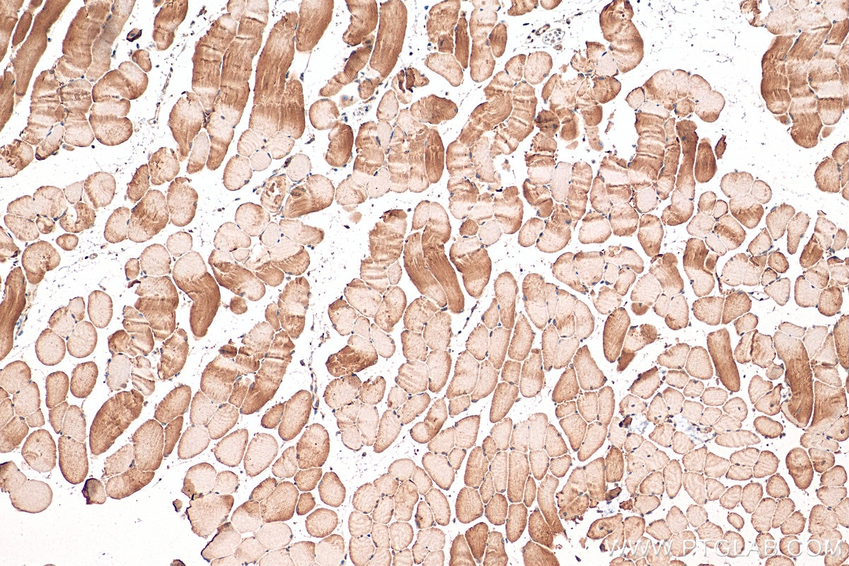 Immunohistochemistry (IHC) staining of mouse skeletal muscle tissue using KBTBD5 Polyclonal antibody (21836-1-AP)