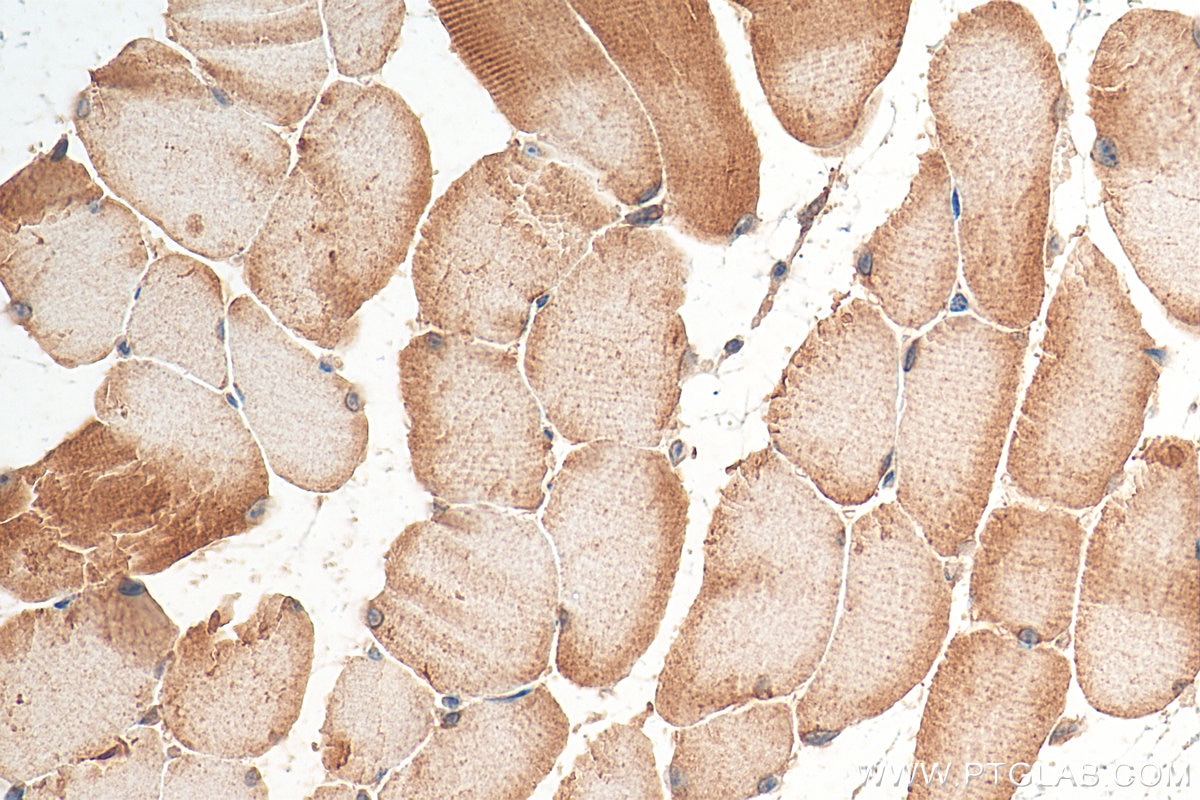 Immunohistochemistry (IHC) staining of mouse skeletal muscle tissue using KBTBD5 Polyclonal antibody (21836-1-AP)