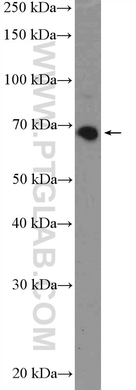 Western Blot (WB) analysis of mouse skeletal muscle tissue using KBTBD5 Polyclonal antibody (21836-1-AP)