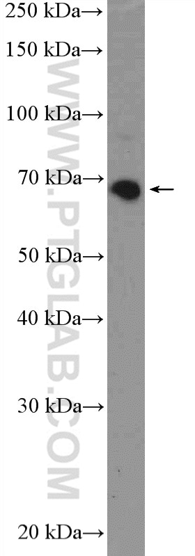 Western Blot (WB) analysis of mouse skeletal muscle tissue using KBTBD5 Polyclonal antibody (21836-1-AP)