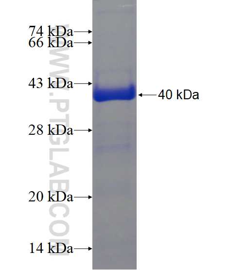KBTBD5 fusion protein Ag16862 SDS-PAGE