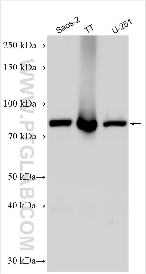 Western Blot (WB) analysis of various lysates using KBTBD6 Polyclonal antibody (31743-1-AP)