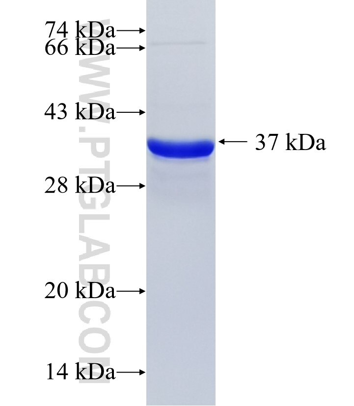 KBTBD6 fusion protein Ag36046 SDS-PAGE