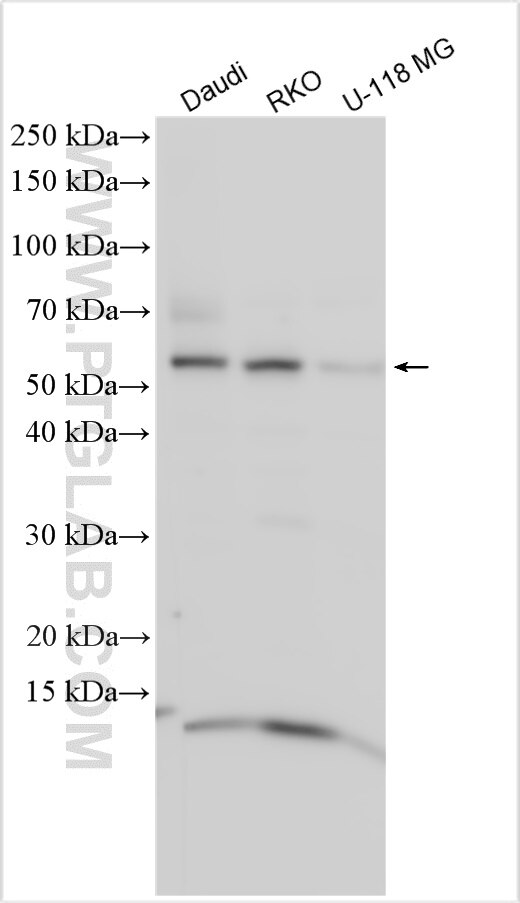 Western Blot (WB) analysis of various lysates using KBTBD8 Polyclonal antibody (31970-1-AP)