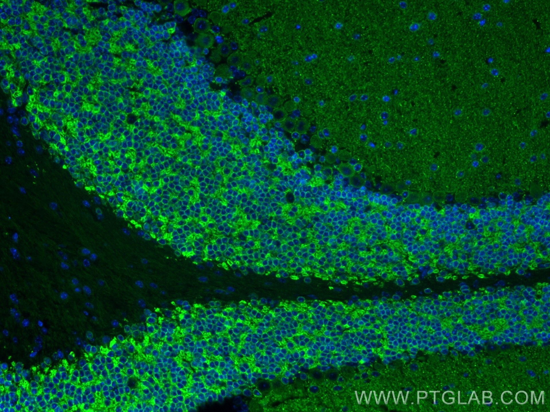 Immunofluorescence (IF) / fluorescent staining of mouse cerebellum tissue using KCC2/SLC12A5 Polyclonal antibody (28724-1-AP)