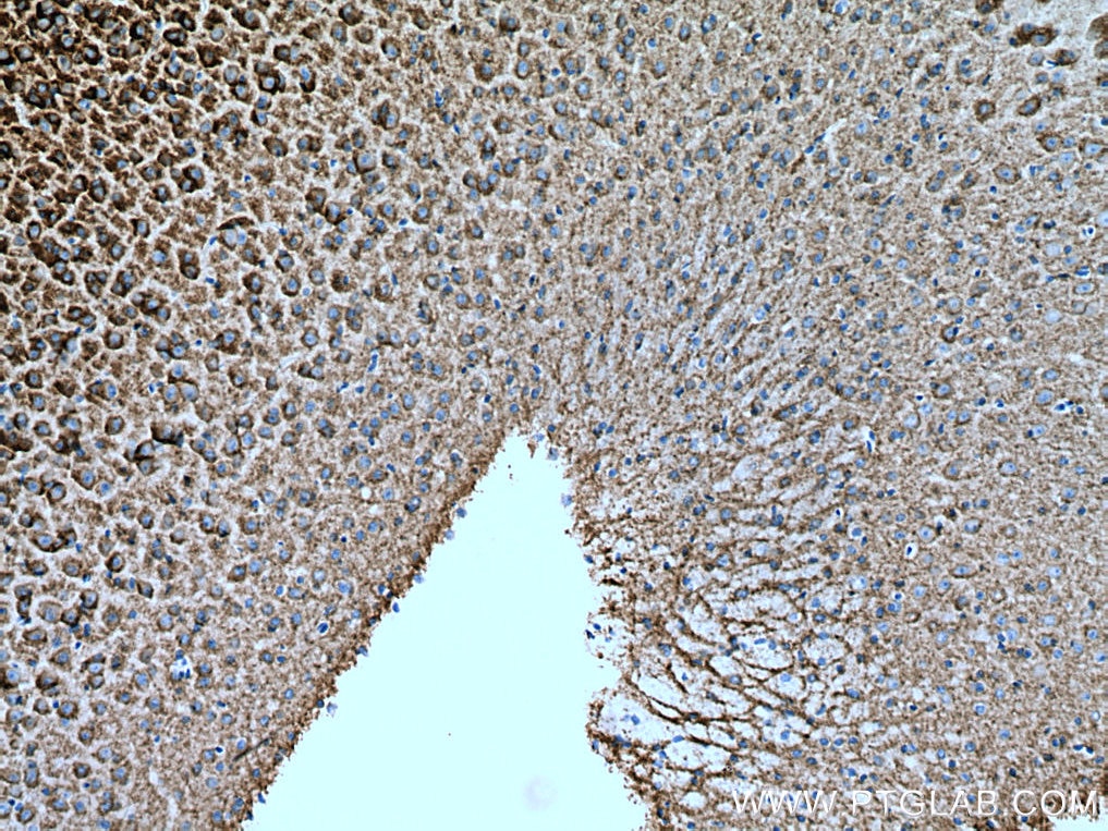 Immunohistochemistry (IHC) staining of mouse brain tissue using KCC2/SLC12A5 Polyclonal antibody (28724-1-AP)