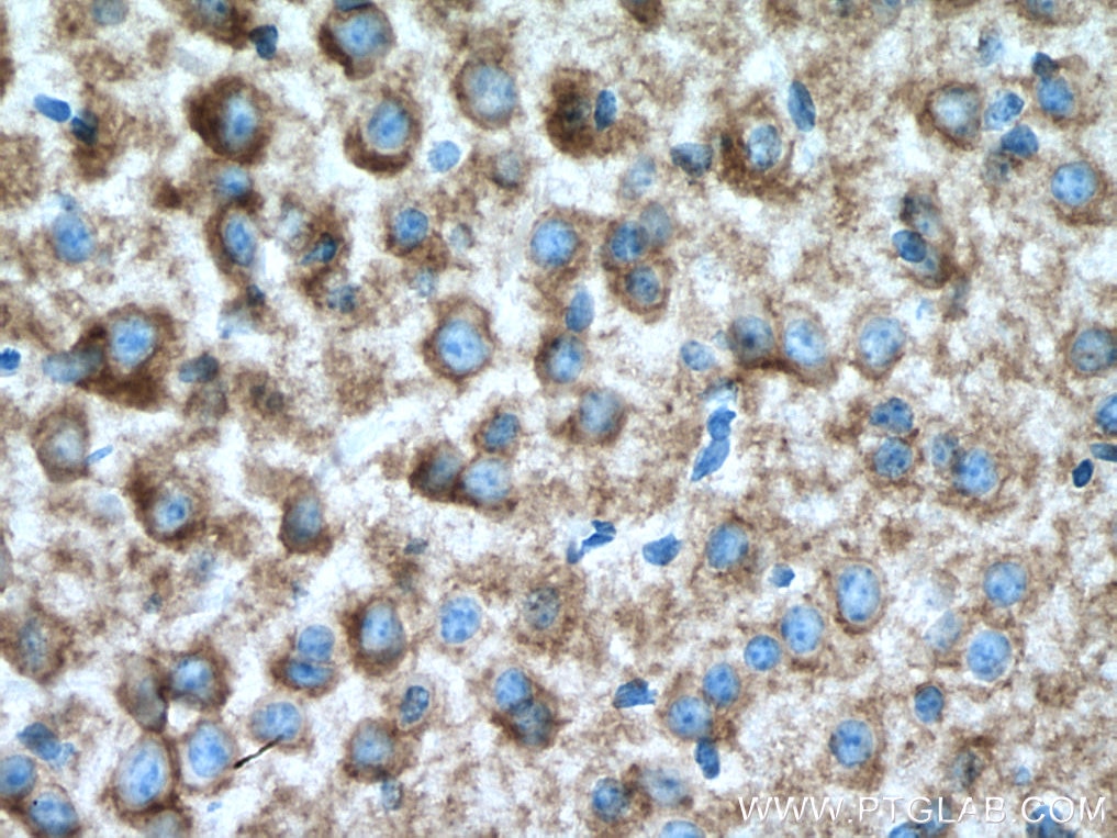 Immunohistochemistry (IHC) staining of mouse brain tissue using KCC2/SLC12A5 Polyclonal antibody (28724-1-AP)