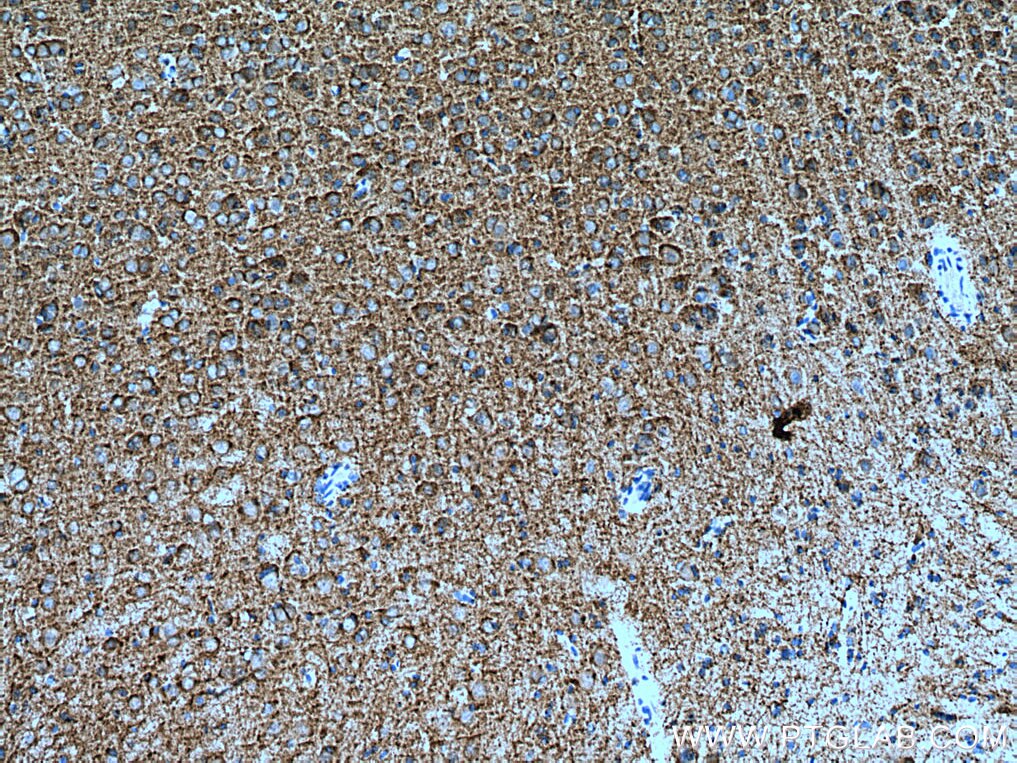 Immunohistochemistry (IHC) staining of rat brain tissue using KCC2/SLC12A5 Polyclonal antibody (28724-1-AP)