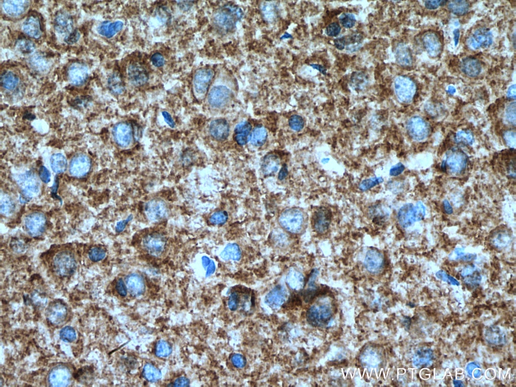 Immunohistochemistry (IHC) staining of rat brain tissue using KCC2/SLC12A5 Polyclonal antibody (28724-1-AP)