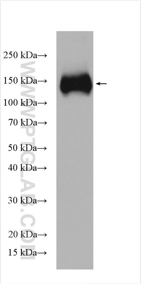 Western Blot (WB) analysis of various lysates using KCC2/SLC12A5 Polyclonal antibody (28724-1-AP)