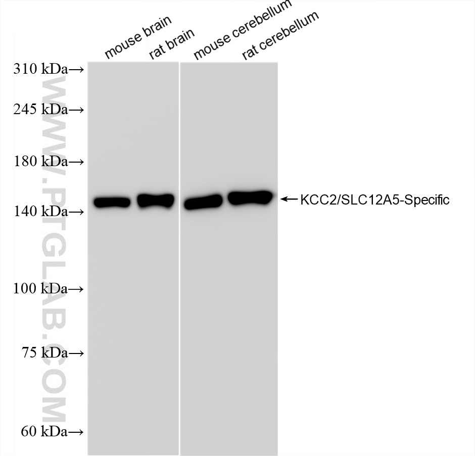 KCC2/SLC12A5-Specific