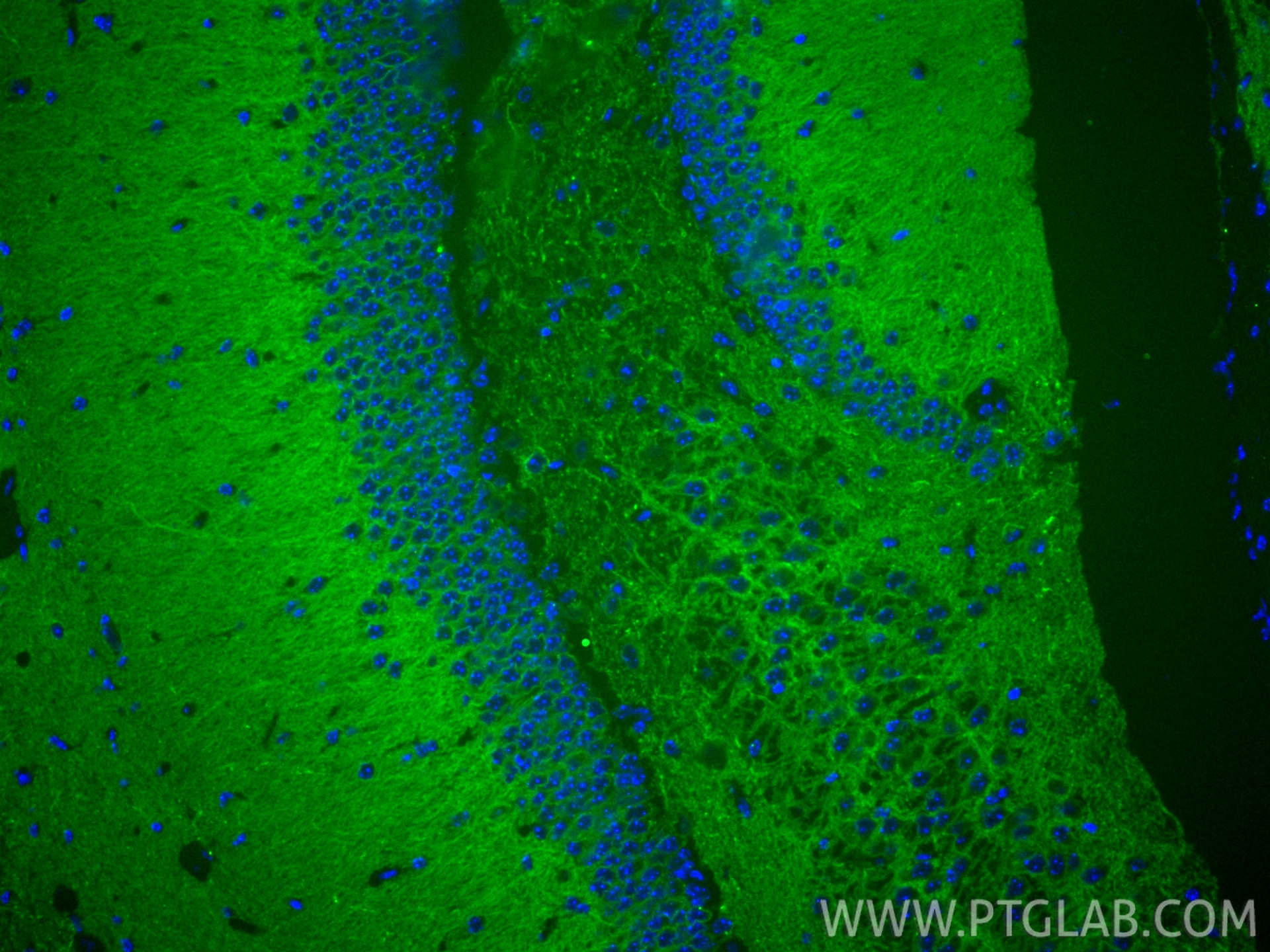 Immunofluorescent analysis of (4% PFA) fixed paraffin-embedded mouse brain tissue using CoraLite® Plus 488 KCC2/SLC12A5-Specific antibody (CL488-19565) at dilution of 1:500. Heat mediated antigen retrieval with Tris-EDTA buffer (pH 9.0). Immunofluorescence (IF) / fluorescent staining of mouse brain tissue using CoraLite® Plus 488-conjugated KCC2/SLC12A5-Specifi (CL488-19565)