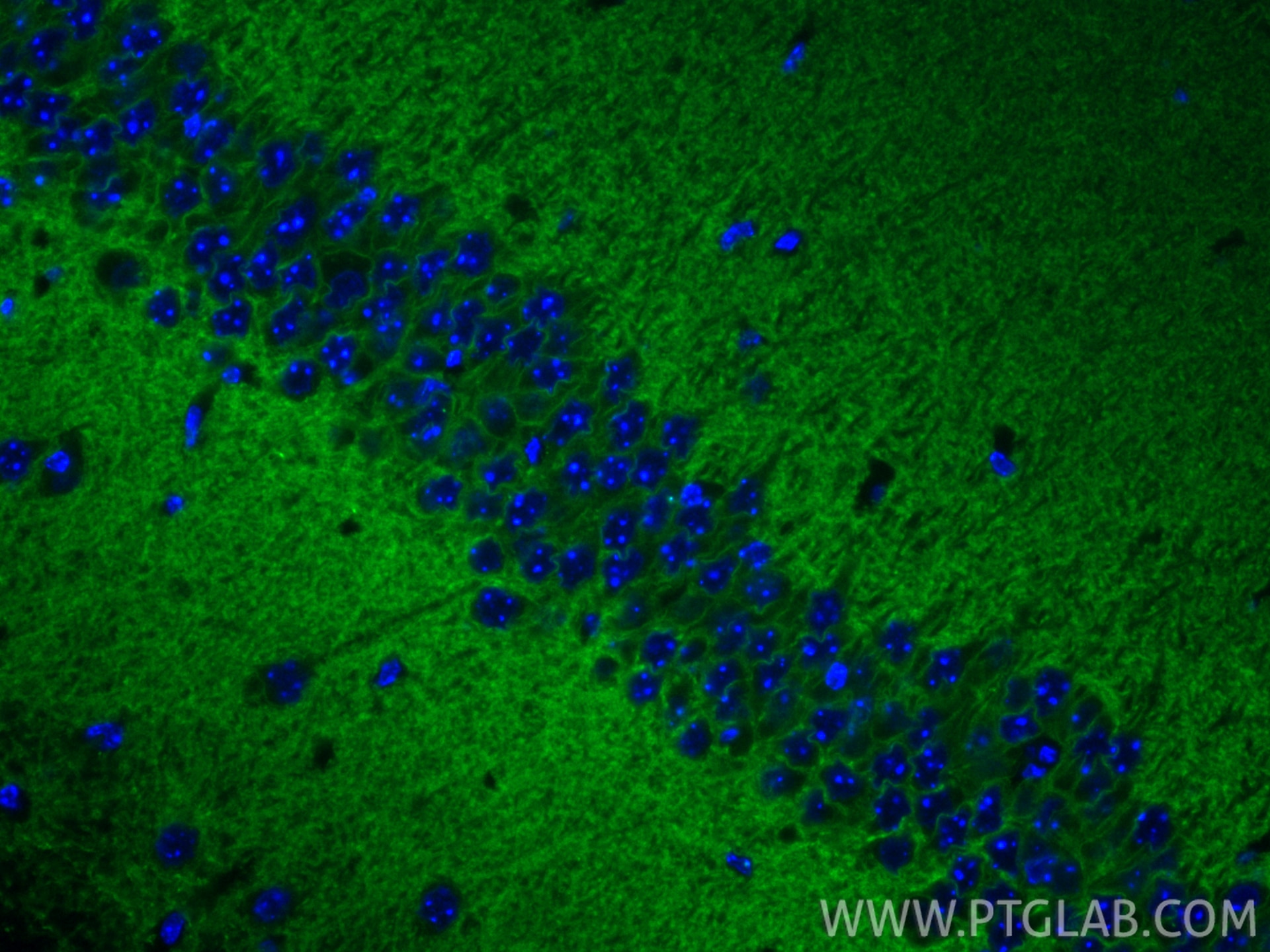 Immunofluorescent analysis of (4% PFA) fixed paraffin-embedded mouse brain tissue using CoraLite® Plus 488 KCC2/SLC12A5-Specific antibody (CL488-19565) at dilution of 1:500. Heat mediated antigen retrieval with Tris-EDTA buffer (pH 9.0). Immunofluorescence (IF) / fluorescent staining of mouse brain tissue using CoraLite® Plus 488-conjugated KCC2/SLC12A5-Specifi (CL488-19565)