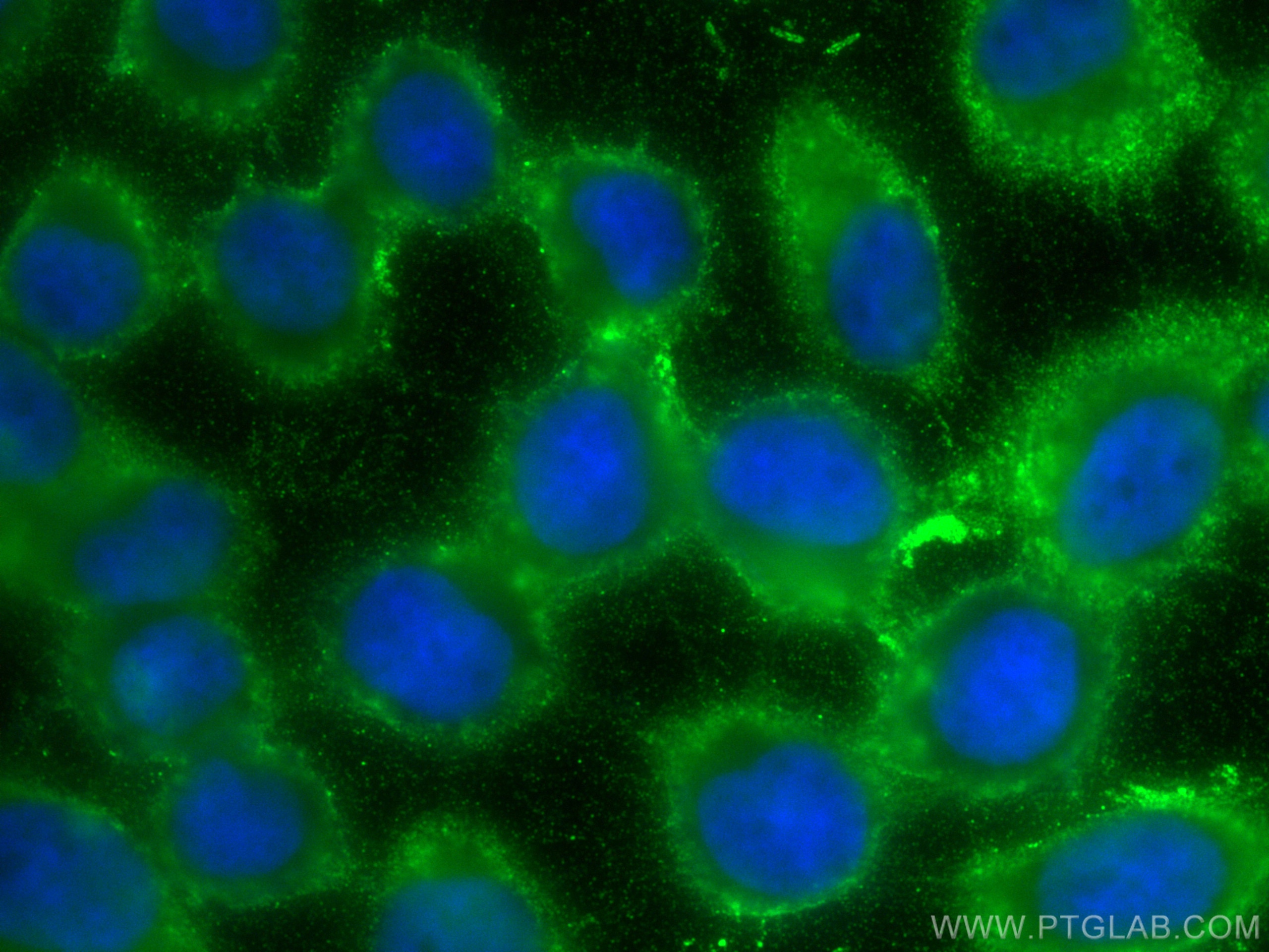 Immunofluorescence (IF) / fluorescent staining of A431 cells using KCC4/SLC12A7 Polyclonal antibody (26590-1-AP)