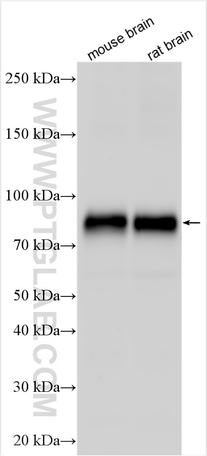 Western Blot (WB) analysis of various lysates using KCNA1 Polyclonal antibody (18067-1-AP)