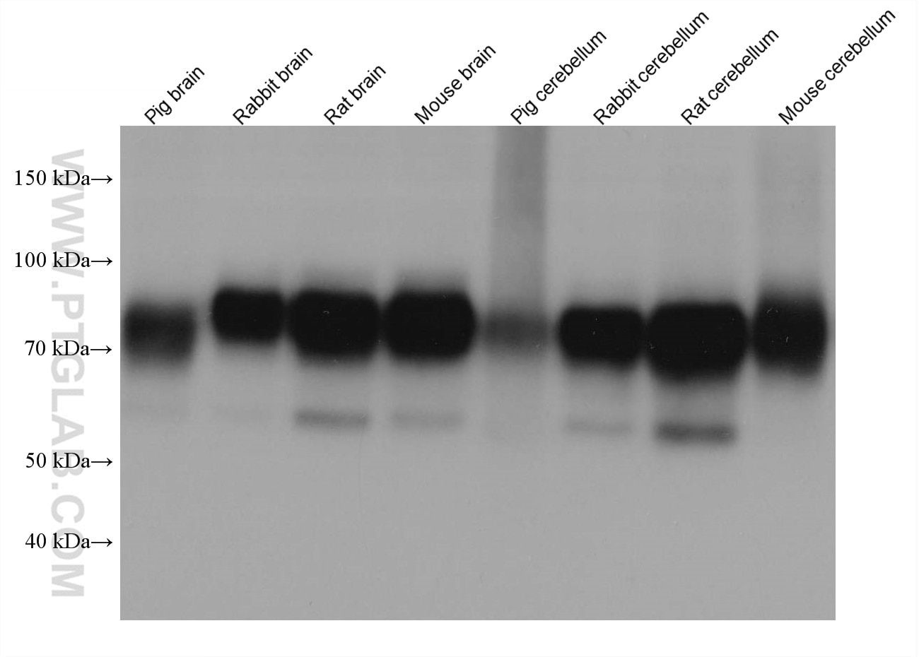 Western Blot (WB) analysis of various lysates using KCNA1 Monoclonal antibody (68008-1-Ig)