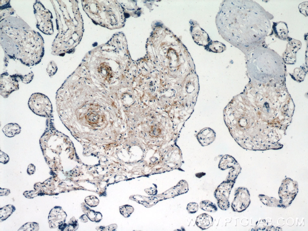 Immunohistochemistry (IHC) staining of human placenta tissue using KCNA10 Polyclonal antibody (18103-1-AP)