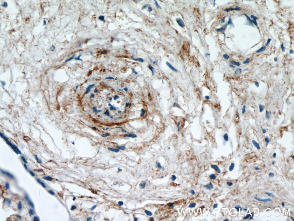 Immunohistochemistry (IHC) staining of human placenta tissue using KCNA10 Polyclonal antibody (18103-1-AP)