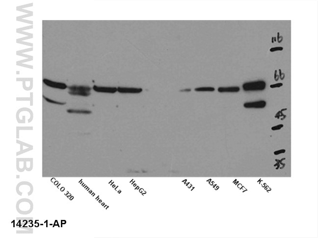 Western Blot (WB) analysis of multi-cells/tissue using Kv1.2 Polyclonal antibody (14235-1-AP)