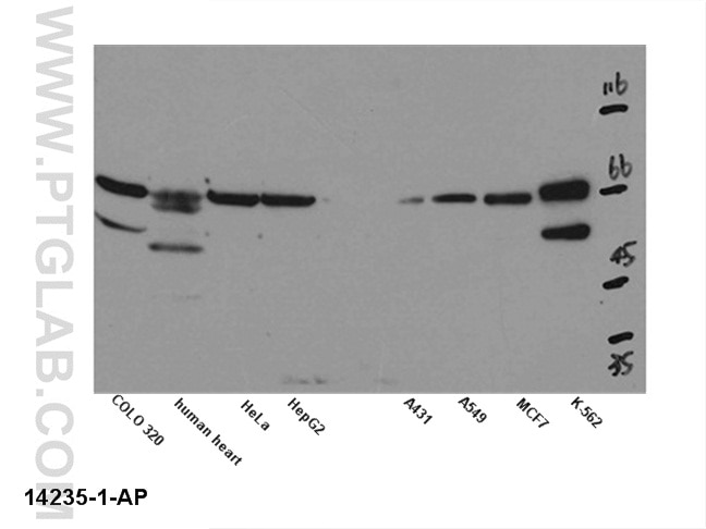 WB analysis of multi-cells/tissue using 14235-1-AP