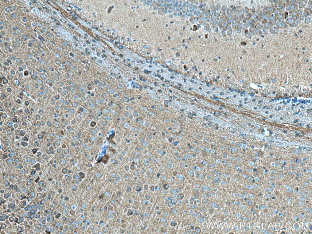 Immunohistochemistry (IHC) staining of mouse brain tissue using Kv1.2 Polyclonal antibody (14235-1-AP)