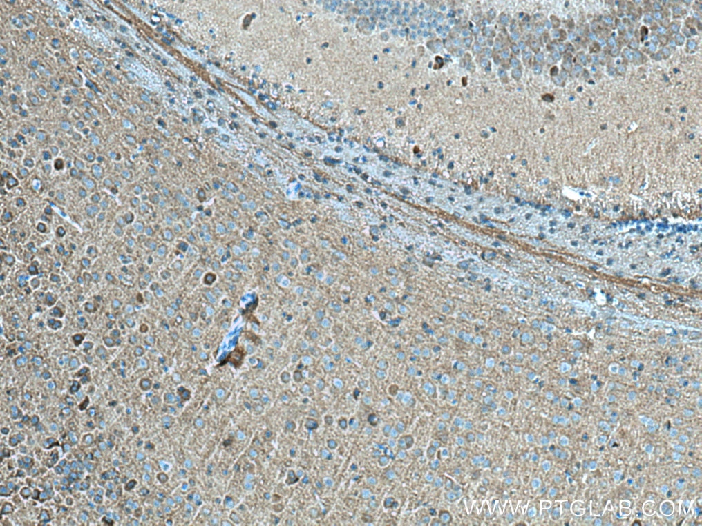 IHC staining of mouse brain using 14235-1-AP