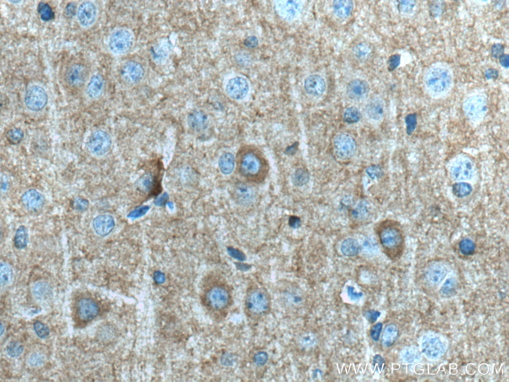 Immunohistochemistry (IHC) staining of mouse brain tissue using Kv1.2 Polyclonal antibody (14235-1-AP)