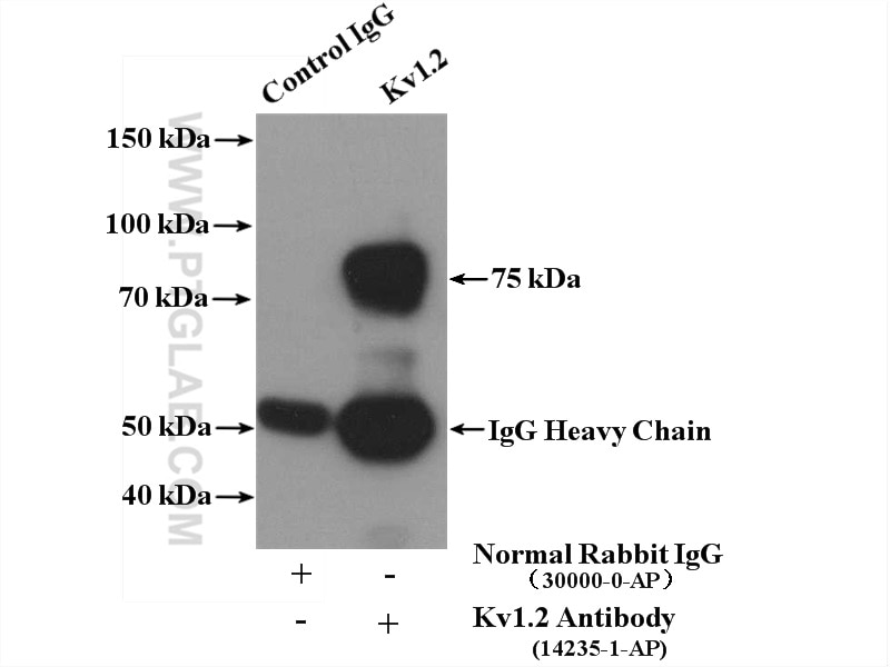 Immunoprecipitation (IP) experiment of HeLa cells using Kv1.2 Polyclonal antibody (14235-1-AP)