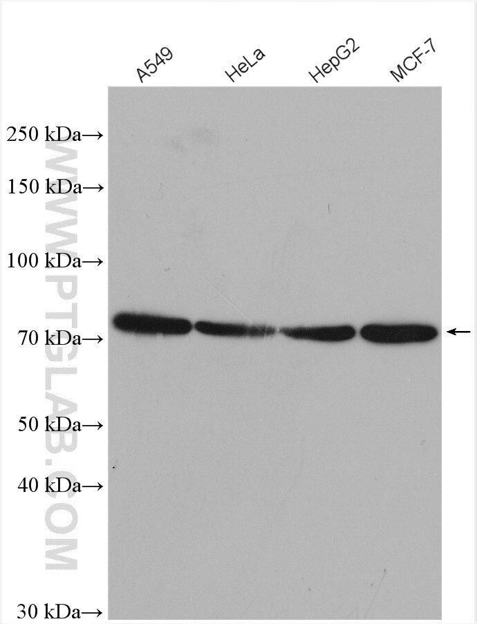 Western Blot (WB) analysis of various lysates using Kv1.2 Polyclonal antibody (14235-1-AP)