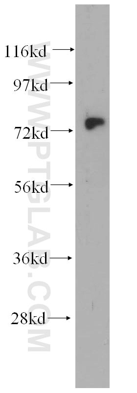 Western Blot (WB) analysis of human heart tissue using Kv1.2 Polyclonal antibody (14235-1-AP)