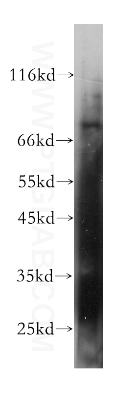 Western Blot (WB) analysis of SH-SY5Y cells using Kv1.2 Monoclonal antibody (60120-1-Ig)