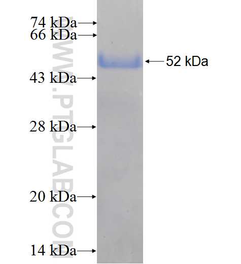 KCNA2 fusion protein Ag5477 SDS-PAGE