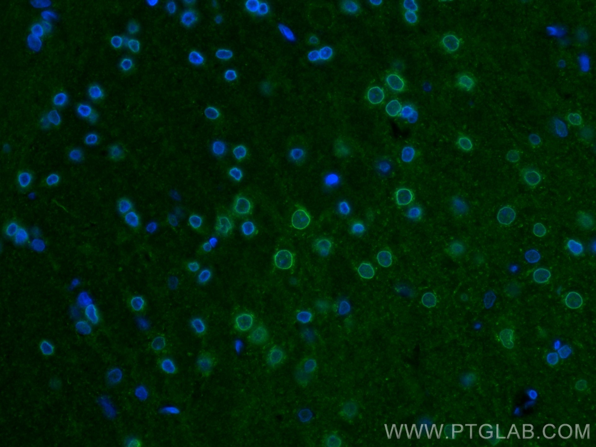 Immunofluorescence (IF) / fluorescent staining of Rat brain tissue using KCNA3 Polyclonal antibody (14079-1-AP)