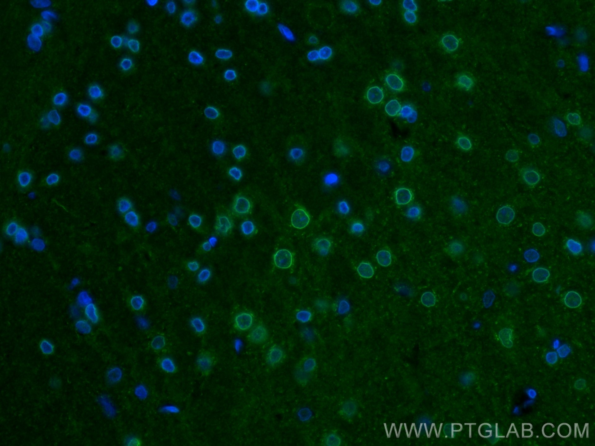 IF Staining of Rat brain using 14079-1-AP