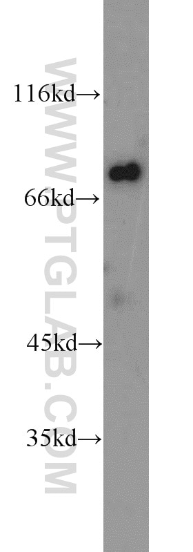 Western Blot (WB) analysis of A549 cells using Kv1.3 Polyclonal antibody (14079-1-AP)