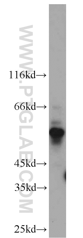 Western Blot (WB) analysis of mouse thymus tissue using Kv1.3 Polyclonal antibody (14079-1-AP)