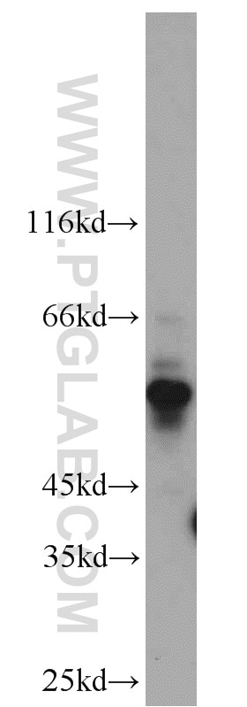 WB analysis of mouse thymus using 14079-1-AP