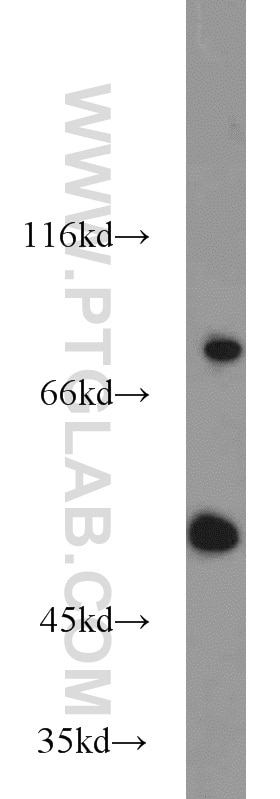 Western Blot (WB) analysis of A549 cells using Kv1.3 Polyclonal antibody (14079-1-AP)