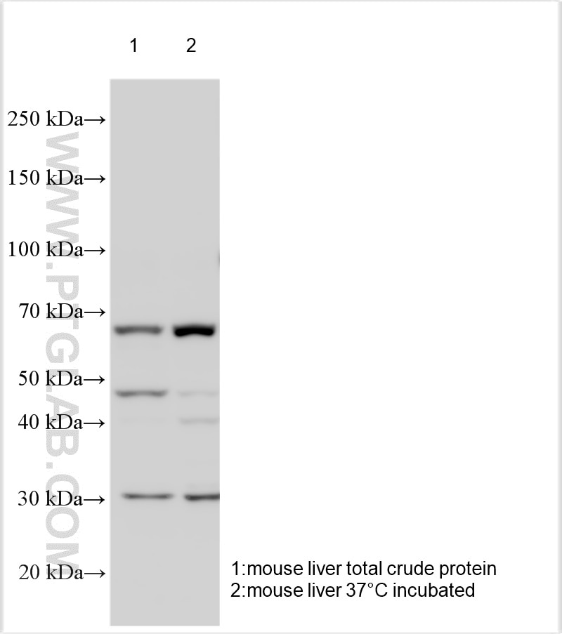 Western Blot (WB) analysis of various lysates using Kv1.4-Specific Polyclonal antibody (19697-1-AP)