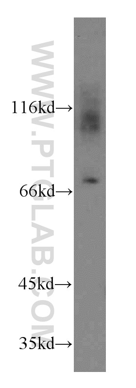 Western Blot (WB) analysis of mouse liver tissue using Kv1.4-Specific Polyclonal antibody (19697-1-AP)