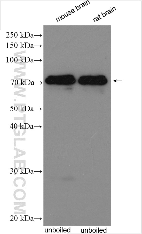 Western Blot (WB) analysis of various lysates using KCNA5 Polyclonal antibody (21659-1-AP)