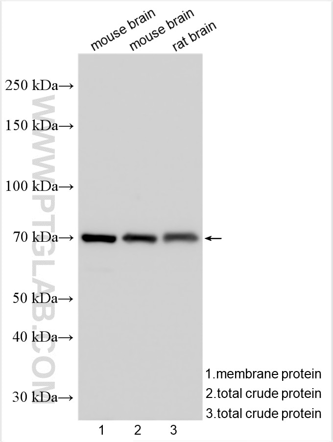 Western Blot (WB) analysis of various lysates using KCNA5 Polyclonal antibody (21659-1-AP)