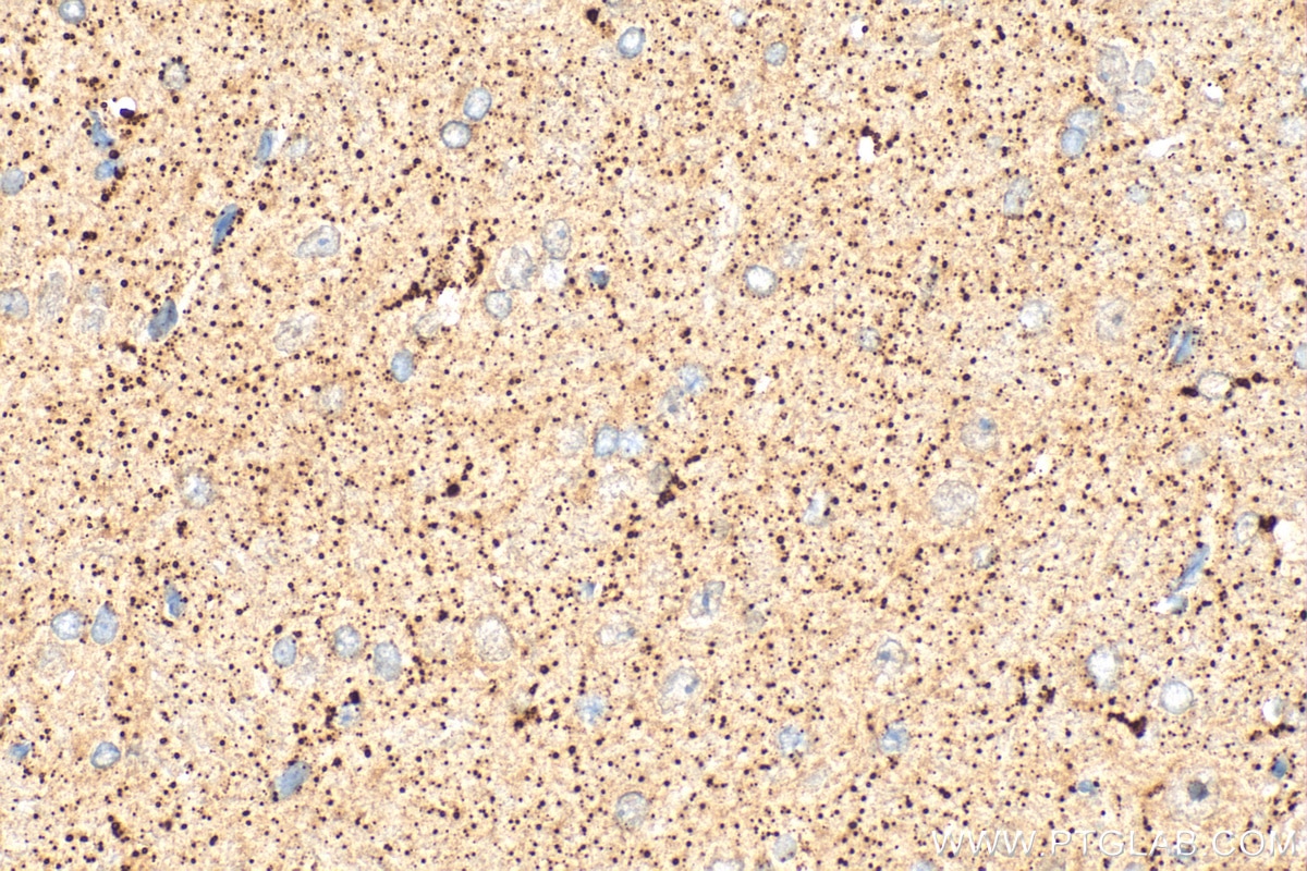 Immunohistochemistry (IHC) staining of rat brain tissue using KCNA6 Polyclonal antibody (31900-1-AP)