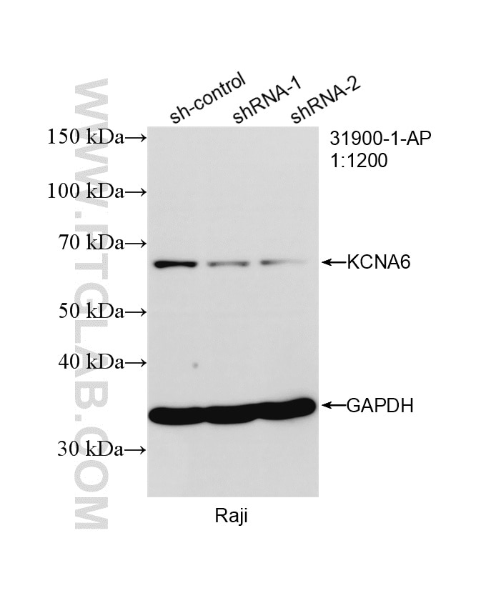 Western Blot (WB) analysis of Raji cells using KCNA6 Polyclonal antibody (31900-1-AP)